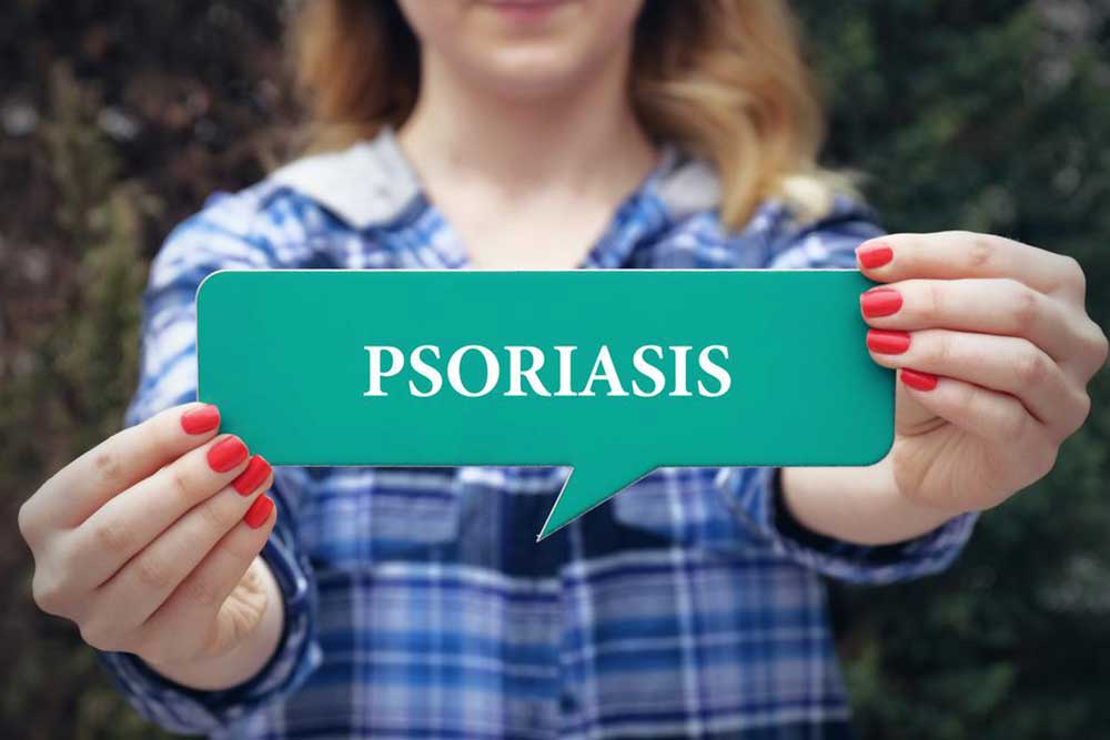 5 Ways to Treat Plaque Psoriasis at Home