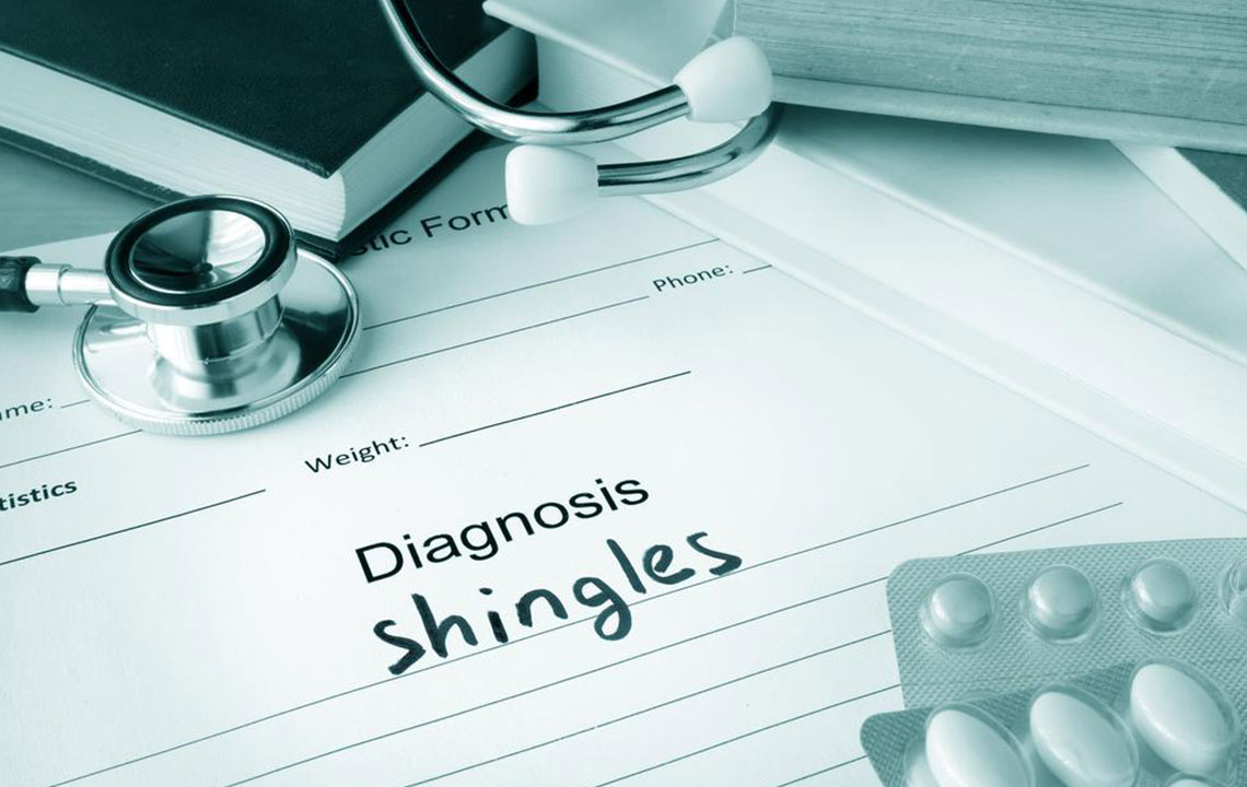 A compact guide to understanding shingles- Causes, symptoms, and treatments