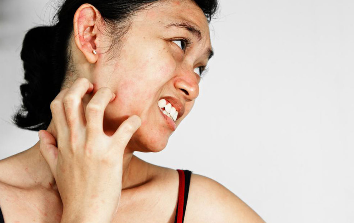 A few common types skin rash that affects people