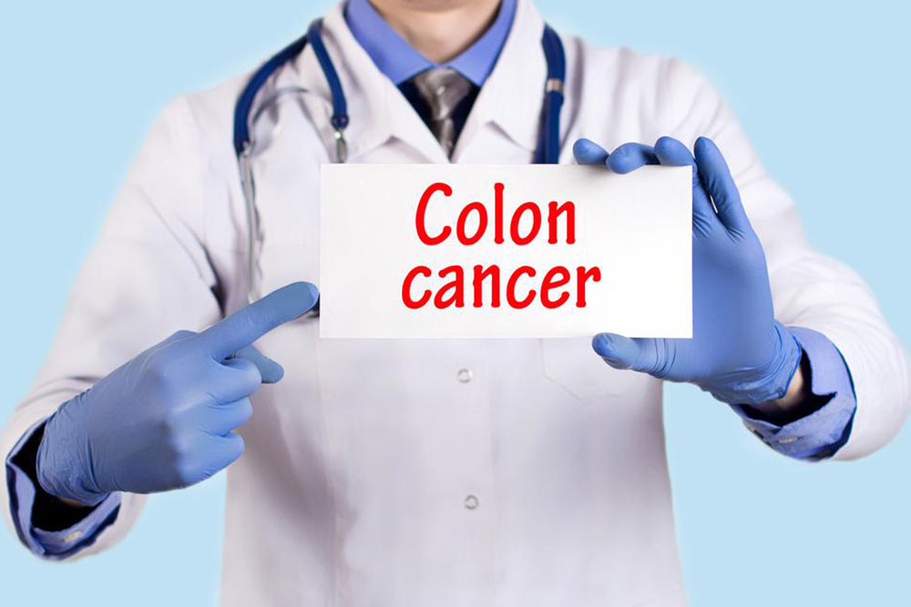 Signs and symptoms of colon cancer