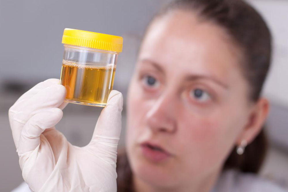 Types of urine colors and what they indicate