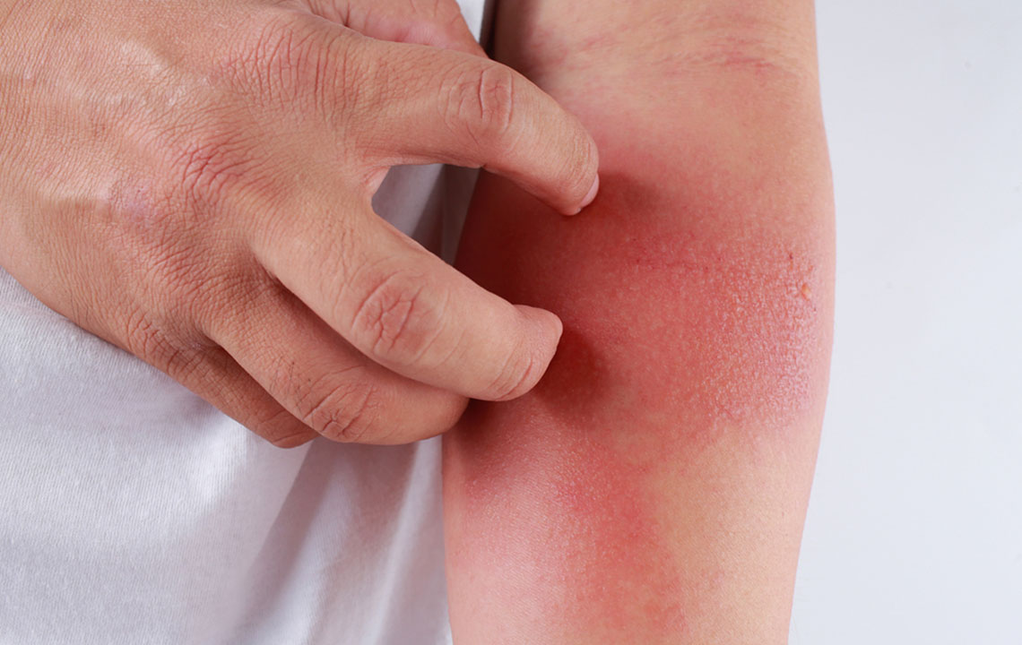 Here&#8217;s How to Identify a Skin Rash