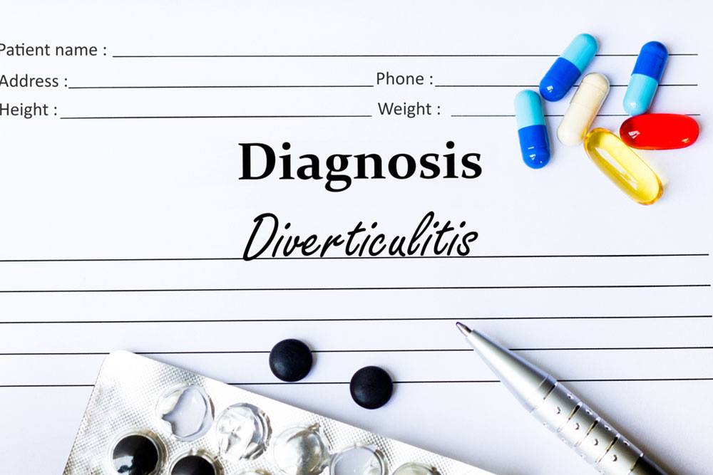 Things to Know about Diverticulitis