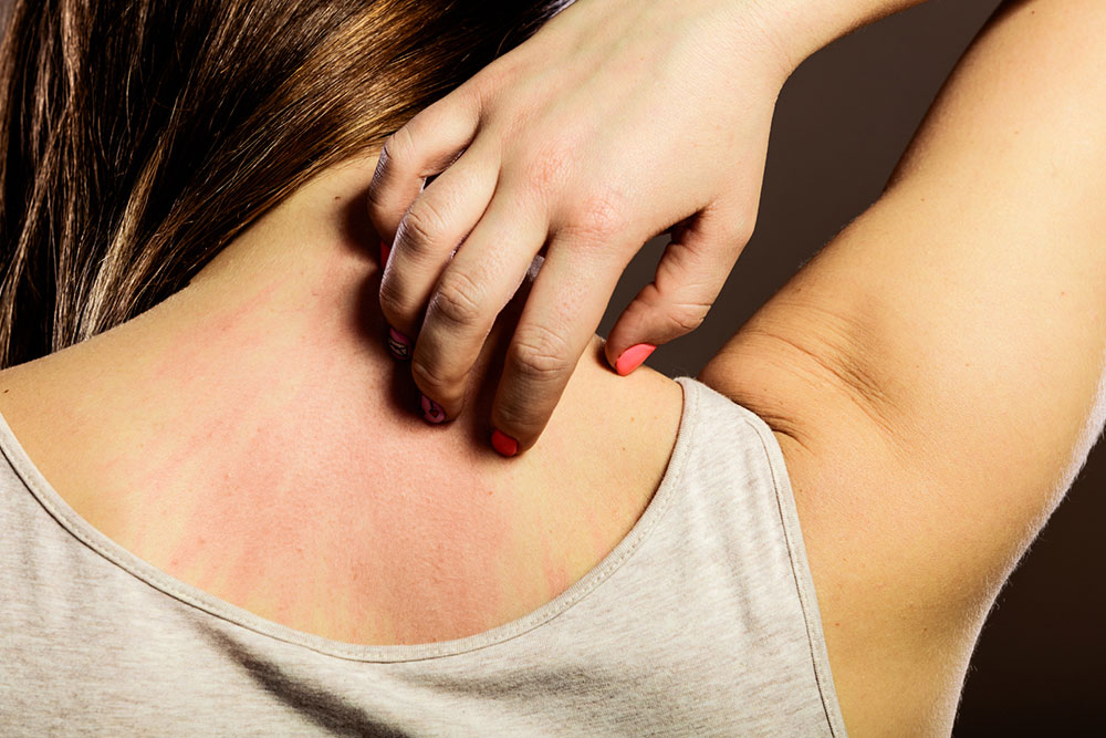 Tips to Treat Pain after Shingles