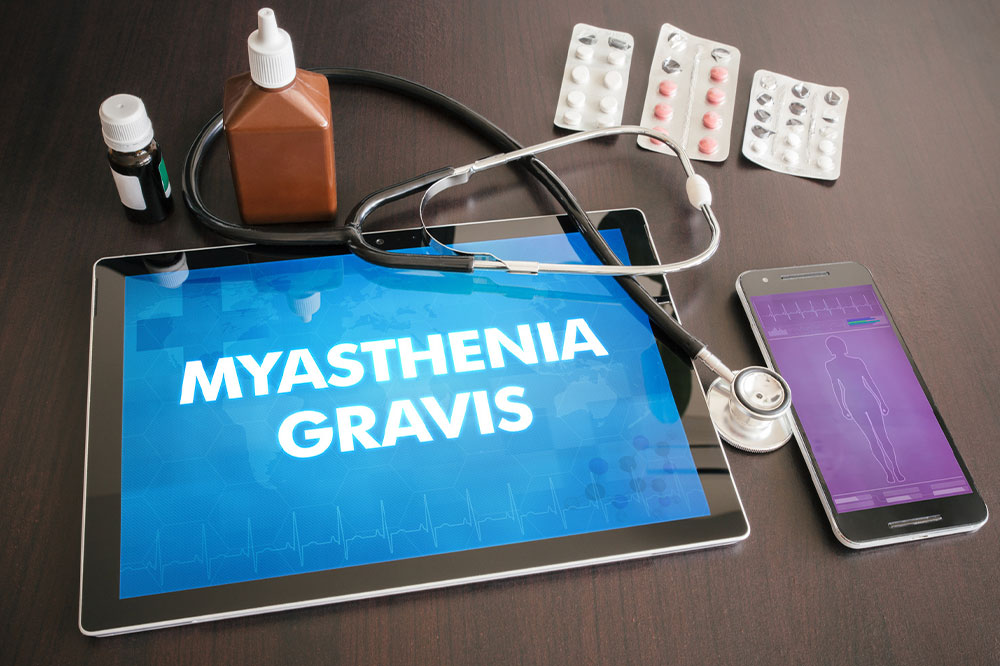 Myasthenia Gravis &#8211; Causes, Symptoms, and Prevention Methods